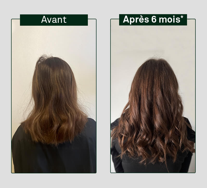 image avant/après